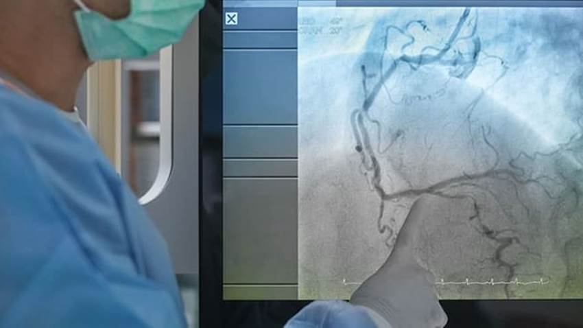 Miocardiopatía hipertrófica: El reto diagnóstico y terapéutico