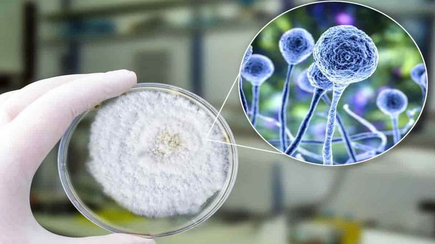 Detectado el primer caso de hongo negro en México