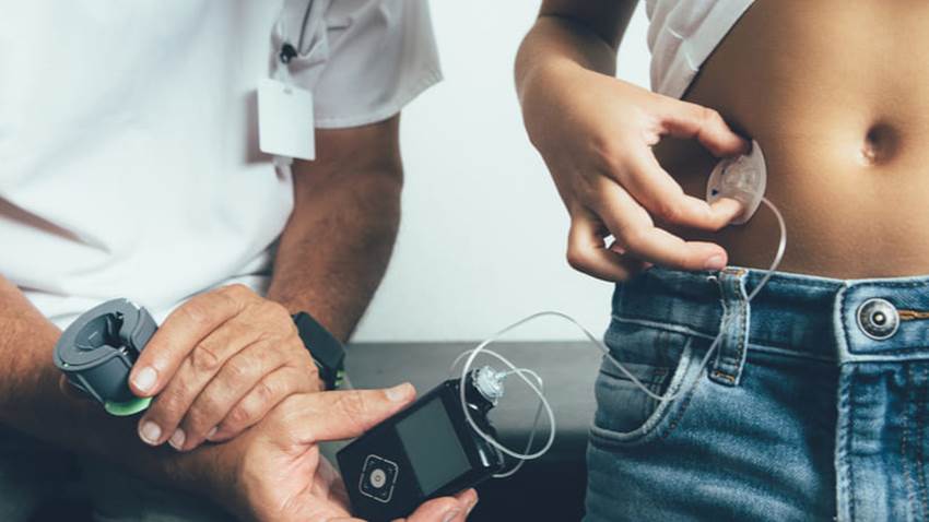 Páncreas artificial logra controlar eficazmente la diabetes en pacientes pediátricos