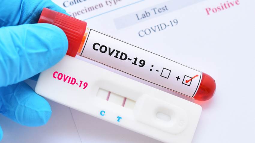 Funcionarios del Departamento de Salud de PR arrojan positivo a COVID-19