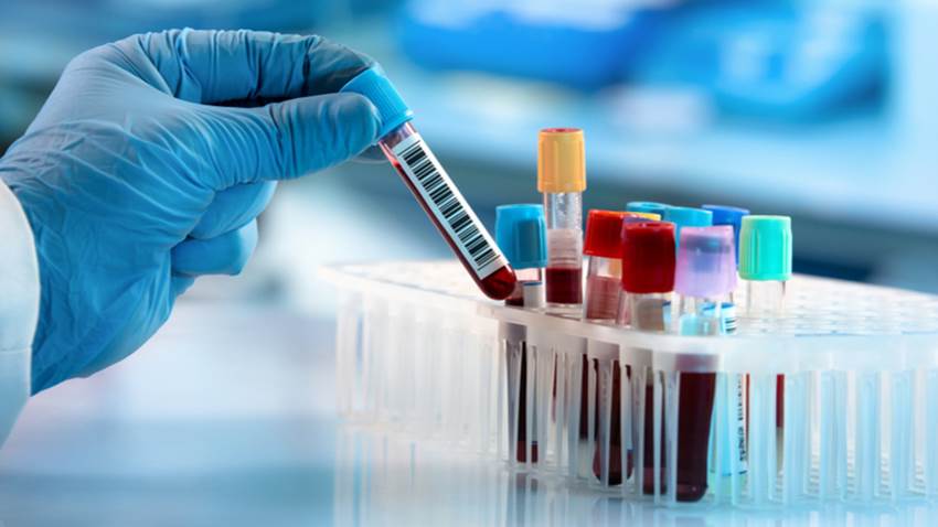 Análisis de sangre podría diagnosticar daño cerebral en neonatos