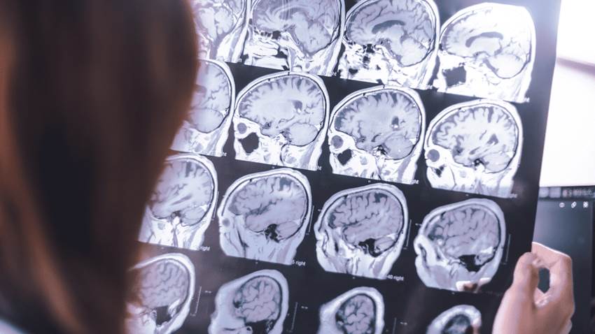 Inicia la convención anual y científica de neurólogos puertorriqueños