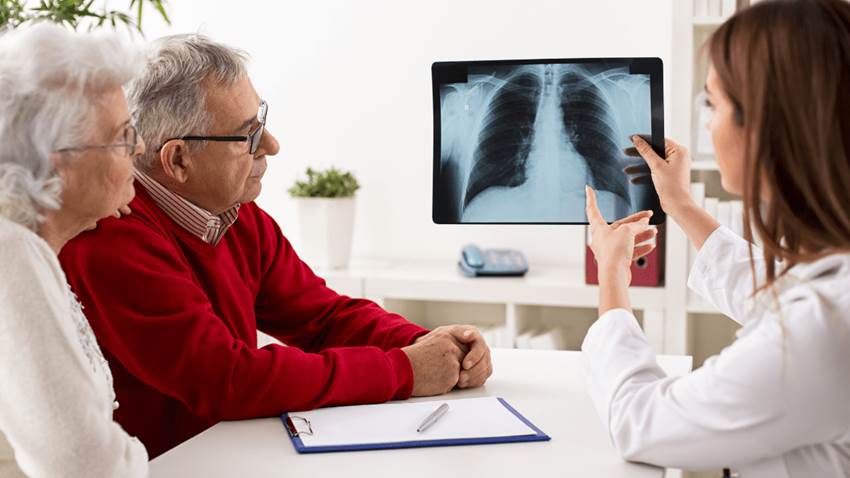 Estilos de vida para el paciente con cáncer de pulmón