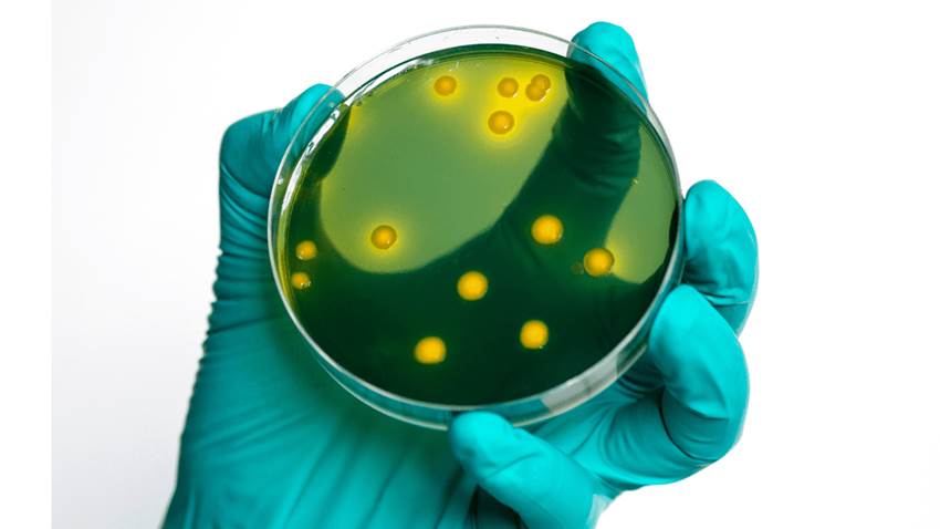 Estudio indica que la mitad de los pacientes crónicos son adherentes a la terapia prescrita