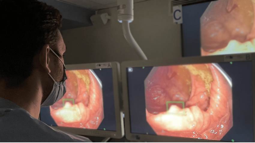 La Inteligencia Artificial en la gastroenterología del futuro