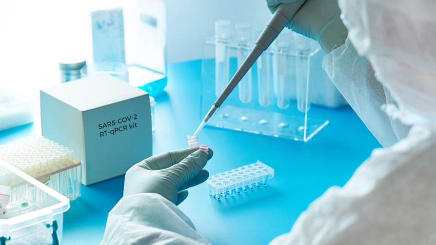 Perfil inmunovirológico plasma sería predictor temprano de la mortalidad por COVID-19, según estudio