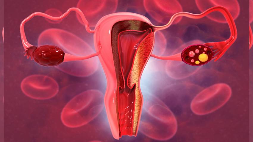 Estudio establece que la ooforectomía bilateral premenopáusica está asociada a deterioro cognitivo