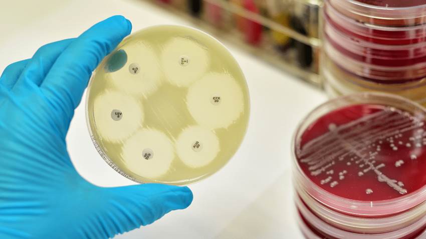 Estudio confirma la resistencia a los antibióticos vinculada a los microplásticos