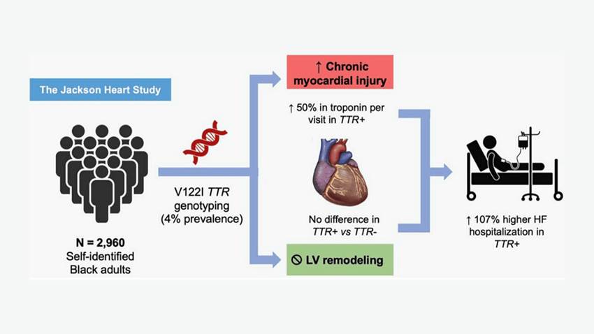 Mutación genética en afroamericanos puede permitir detección temprana de la insuficiencia cardiaca