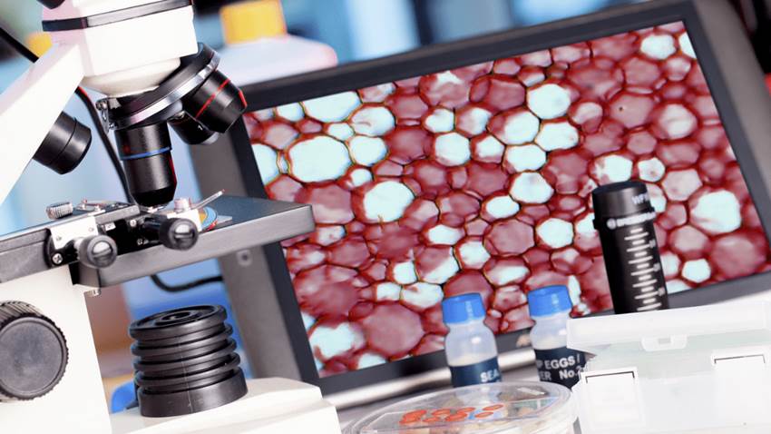 La biopsia líquida, un proceso prometedor para diagnosticar el cáncer de cabeza y cuello asociado al VPH