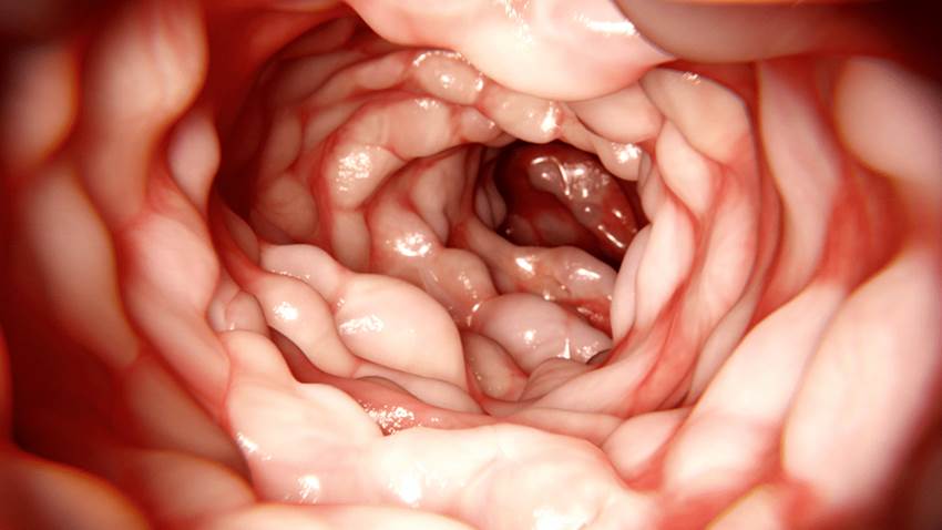 Estudio sostiene respuesta biológica favorable de pacientes puertorriqueños con EII a la vacuna de COVID