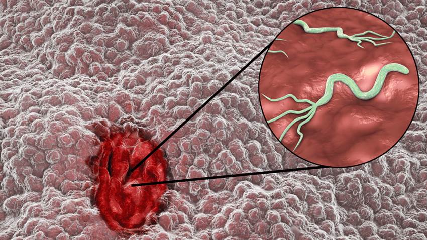 Personal de laboratorios comienza a escasear en la Isla, confirma la Asociación de Laboratorios