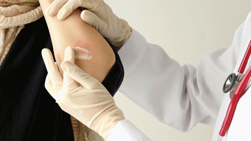 Revelan cómo los anticuerpos neutralizan el virus de la fiebre hemorrágica