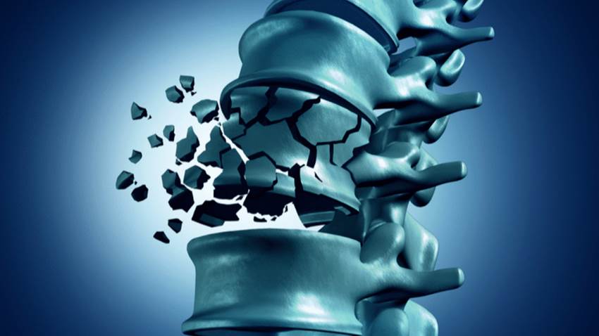 Inyección de moléculas ´danzantes´ repara lesiones graves de médula espinal en ratones