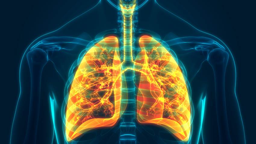 Itepekimab, un nuevo anticuerpo monoclonal que sería beneficioso para el asma grave