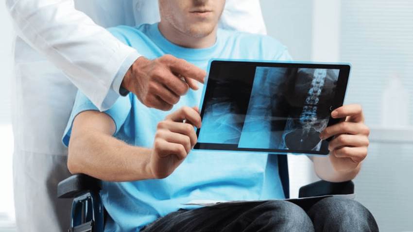 Estudio confirma que dejar de fumar desacelera avance de la Esclerosis Múltiple