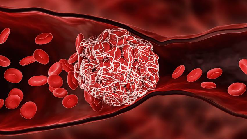 Síntomas a tomar en cuenta luego de la vacunación contra COVID-19