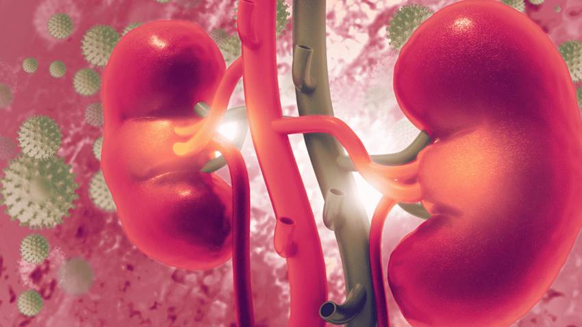 Estudian asociación entre la nefropatía crónica y riesgo de cáncer