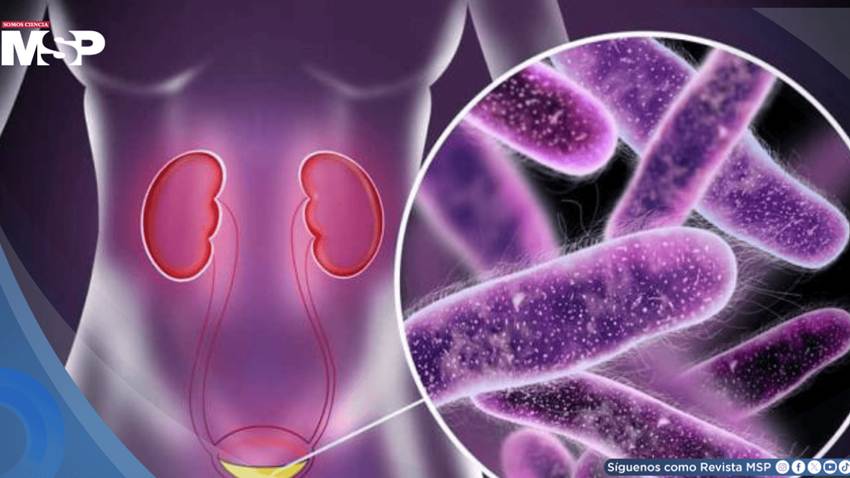 ¿Infección urinaria o renal? Cómo diferenciarlas, prevenirlas y evitar la resistencia bacteriana