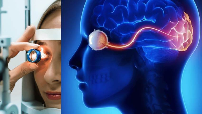 Estudio revela que un simple escaneo de retina podría predecir el riesgo de accidente cerebrovascular