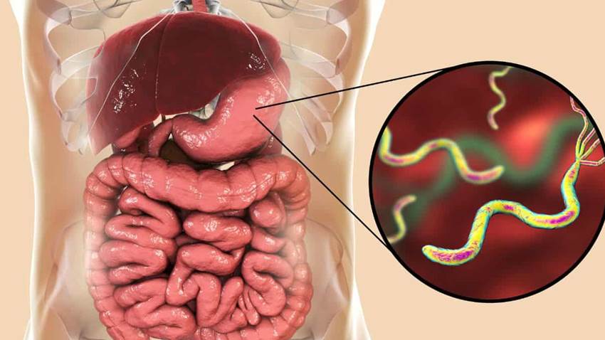 Actualizan guías diagnósticas para la detección de Helicobacter Pylori: Estos son los nuevos enfoques