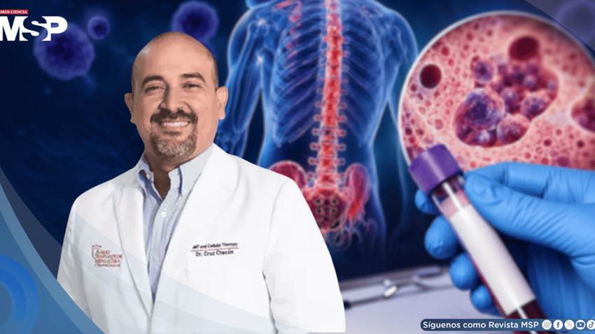 Mielofibrosis: ¿qué es el cáncer de médula ósea que enfrentó el alcalde de Cataño?
