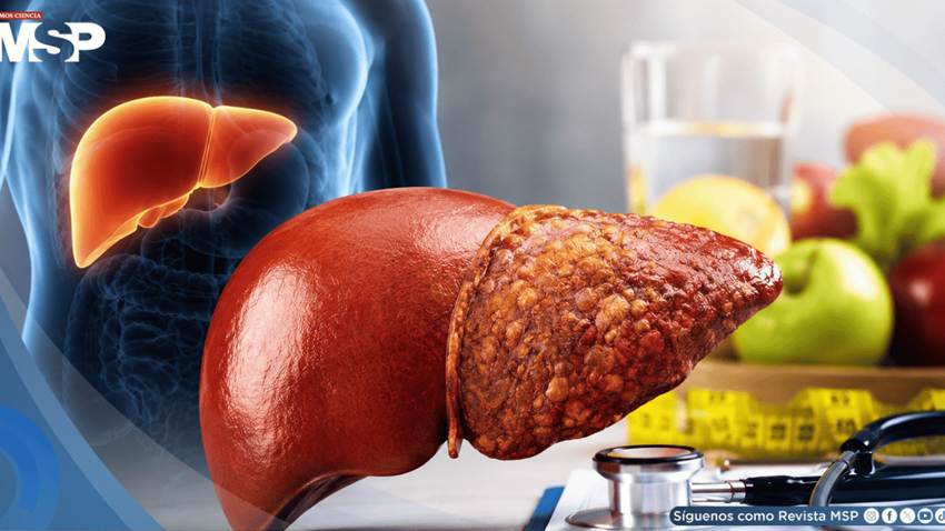 Cirrosis hepática: las señales de alerta y los factores que aumentan el riesgo de esta enfermedad