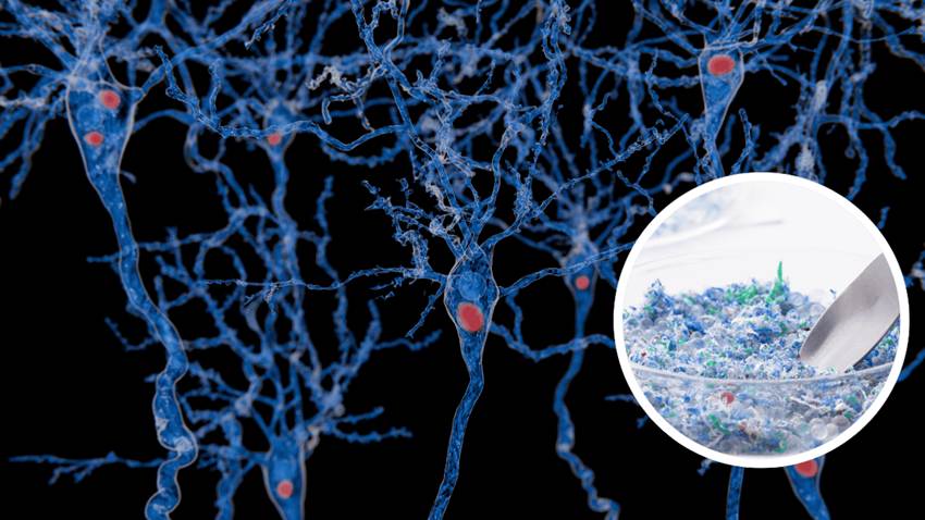 Detectan microplásticos en el cerebro con niveles hasta cinco veces mayores en personas con demencia