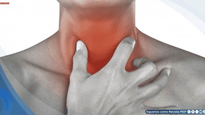 Esofagitis por reflujo gastroesofágico: presentación de un caso clínico