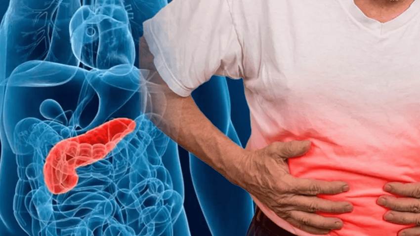Descubren que el fármaco daraxonrasib podría inhibir mutaciones KRAS en cáncer de páncreas