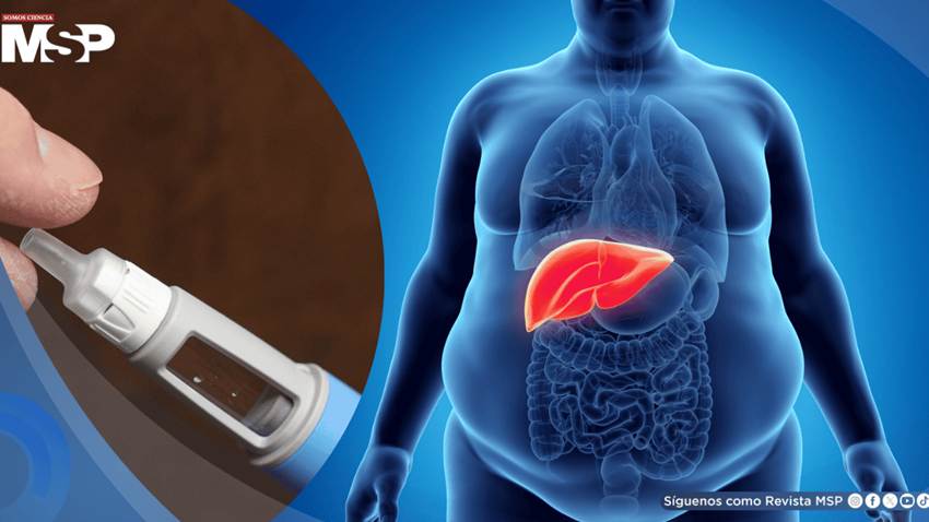 Fármaco contra la diabetes y obesidad muestra beneficios potenciales en hígado graso