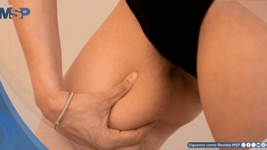 ¿Grasa en las piernas? Podría ser más dañina para la salud cardiometabólica que la del abdomen