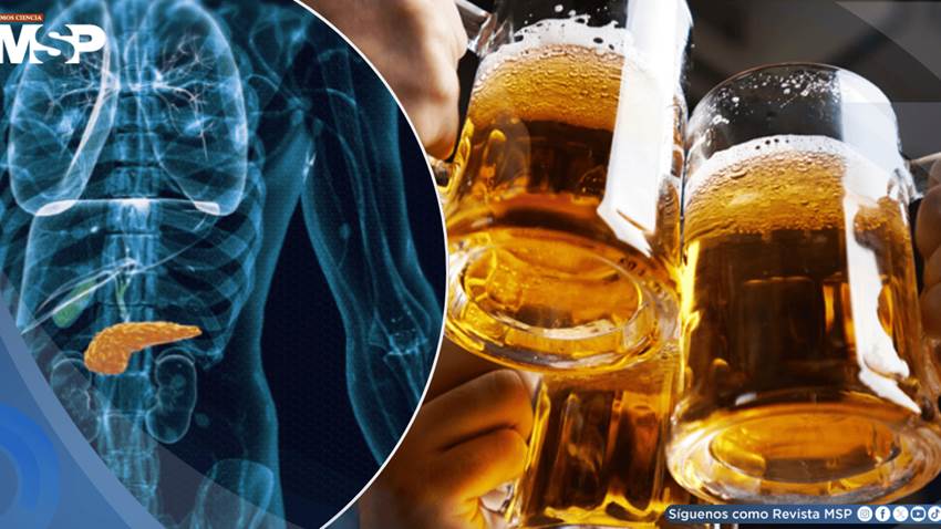 Estudio revela posible vínculo entre el consumo de alcohol y el aumento del riesgo de cáncer de páncreas