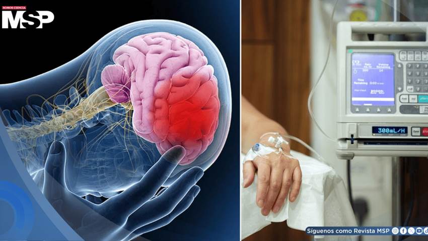 Quimioterapia se asocia a atrofia cerebral en pacientes con cáncer de mama