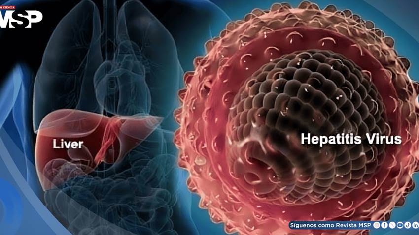 ¿Fatiga constante, dolor abdominal o piel amarillenta? Podrían ser síntomas de hepatitis autoinmune