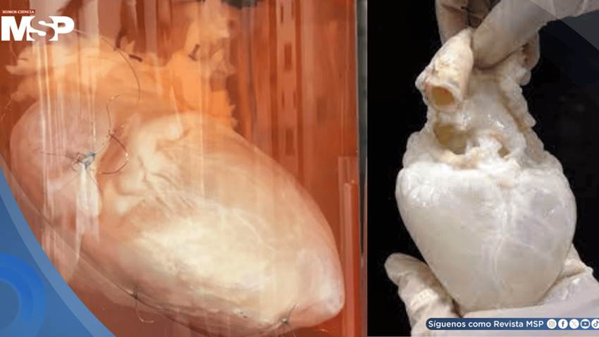 Órganos fantasma: Así funciona la bioingeniería que busca acabar con la lista de espera de trasplantes