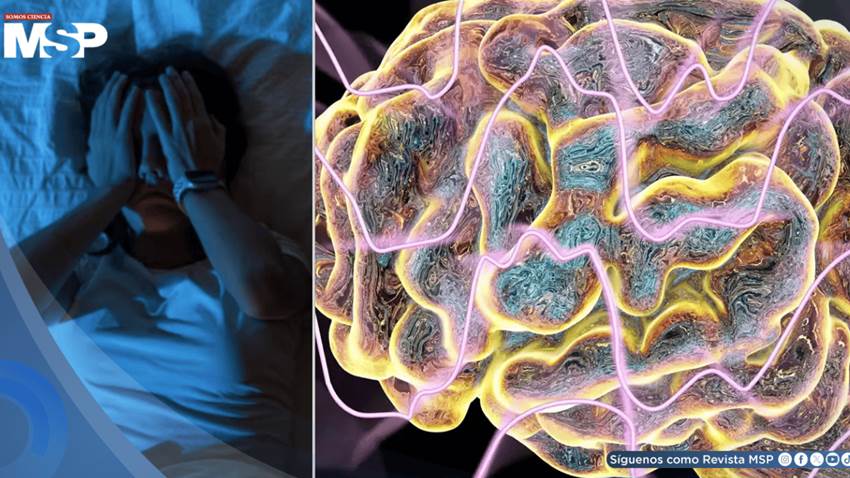 ¿Escucha estallidos o disparos al dormir? Podría ser el síndrome de cabeza explosiva