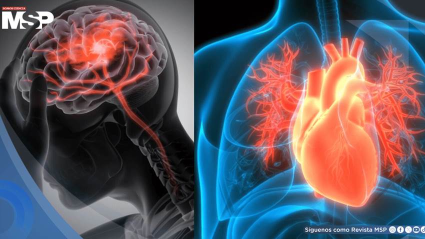 Científicos revelan por qué mujeres aparentemente sanas enfrentan alto riesgo de infarto y ACV