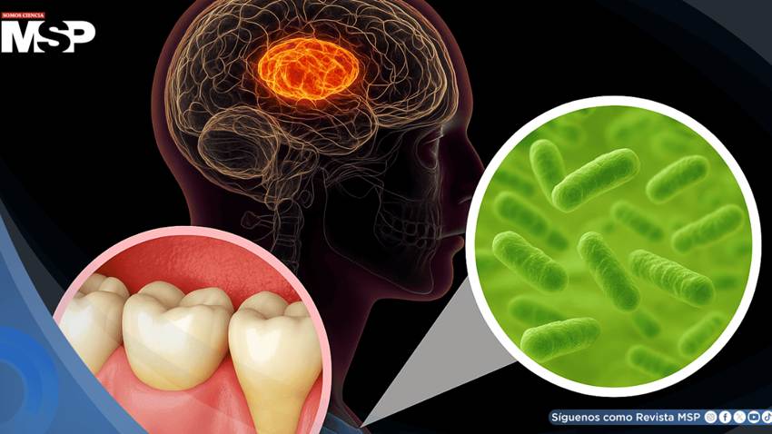 Descubren que esta bacteria común en la boca podría relacionarse con la enfermedad de párkinson