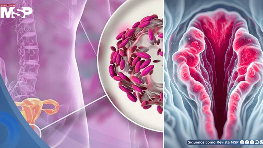 Picazón, irritación e inflamación en la vulva: Así podría manifestarse la dermatitis vulvar