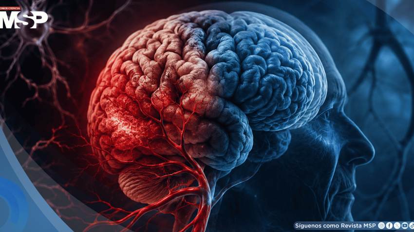 No todo deterioro cognitivo es alzhéimer: la demencia vascular es la segunda causa más frecuente