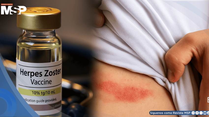 Vacuna recombinante contra el herpes zóster demuestra más del 50% de eficacia en inmunodeprimidos