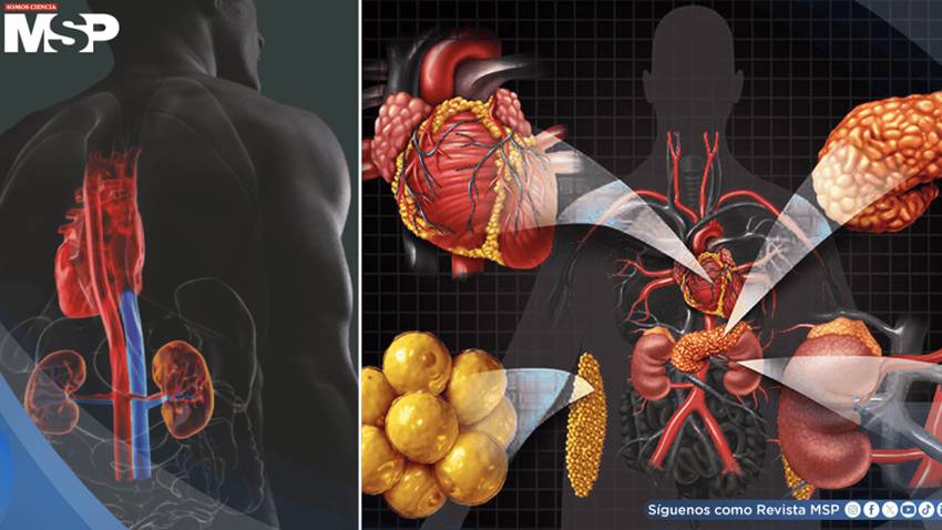 Qué es el síndrome cardiovascular renal-metabólico, que podría afectar a 9 de cada 10 adultos
