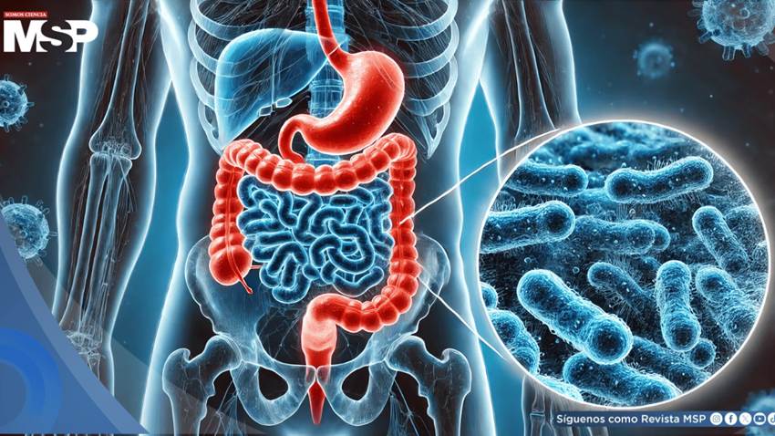 Aditivos en ultraprocesados podrían debilitar la barrera intestinal  e incrementar la inflamación