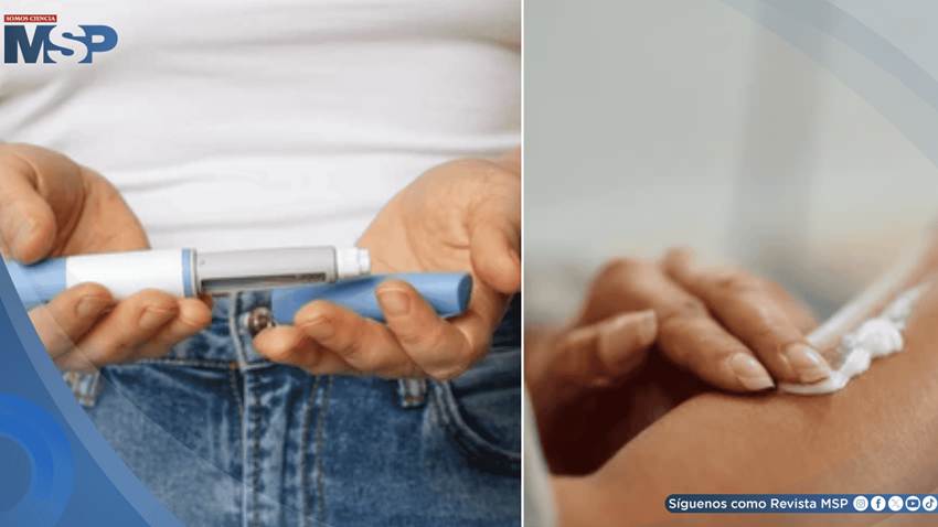 Así funcionaría la insulina en crema: Avance podría eliminar los pinchazos para pacientes diabéticos