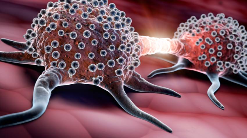 10 datos para entender el mieloma múltiple