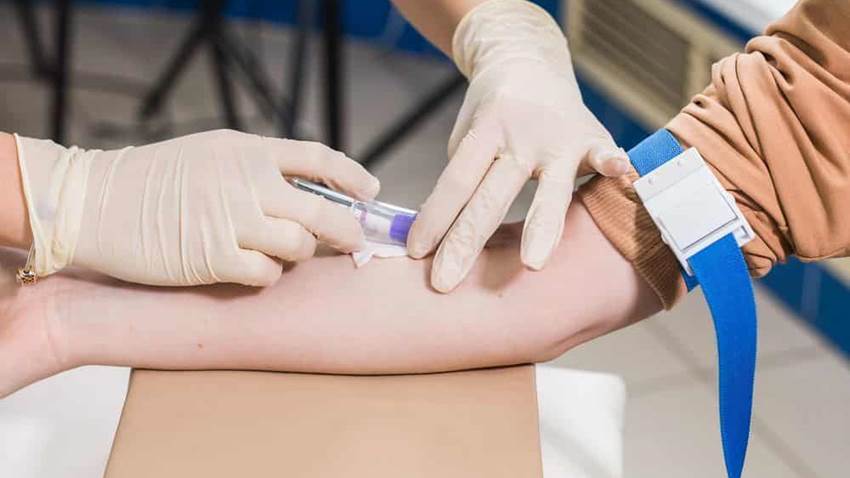 Un análisis de sangre ayuda a predecir quien puede beneficiarse del cribado del Cáncer de Pulmón