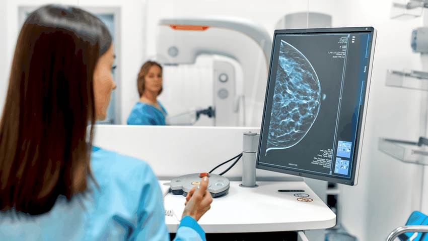 Inteligencia artificial ayudaría a detectar el cáncer de mama de una forma más precisa