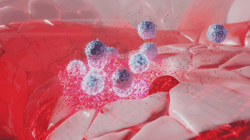 Nueva esperanza para las pacientes con cáncer triple negativo en Puerto Rico