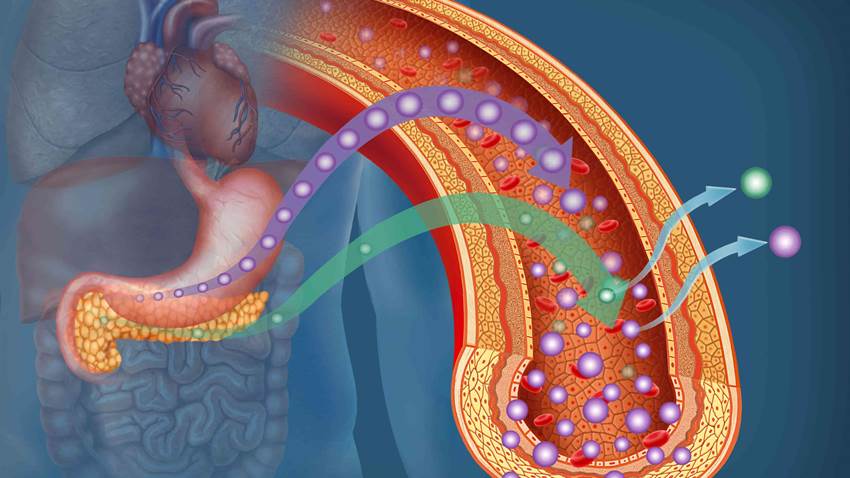¿Qué tan común es la remisión de pacientes con diabetes tipo 2?